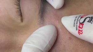 162 • Acne collection • АСМР • Relax Spa