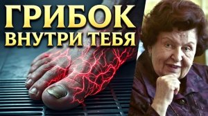 ЕСЛИ ВИДИТЕ ГРИБОК НА НОГТЯХ — ВЫ УЖЕ ОПОЗДАЛИ! Вот где всё начинается. Наталь