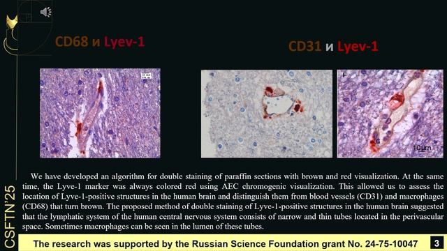 Using A Dual System Of Dual Immunohistochemical Staining To Identify Lyve-1-positive Structures ...