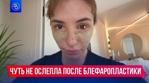 Блогерша Саша Коцкая едва не ослепла после блефаропластики
