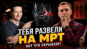 Вам не нужна операция! Врач-ортопед про обман на МРТ, уколы гиалуронки и больные колени