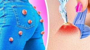 КАК УДАЛИТЬ ПРЫЩИ! УМНЫЕ БЬЮТИ-СОВЕТЫ, КОТОРЫЕ СЛЕДУЕТ ЗНАТЬ