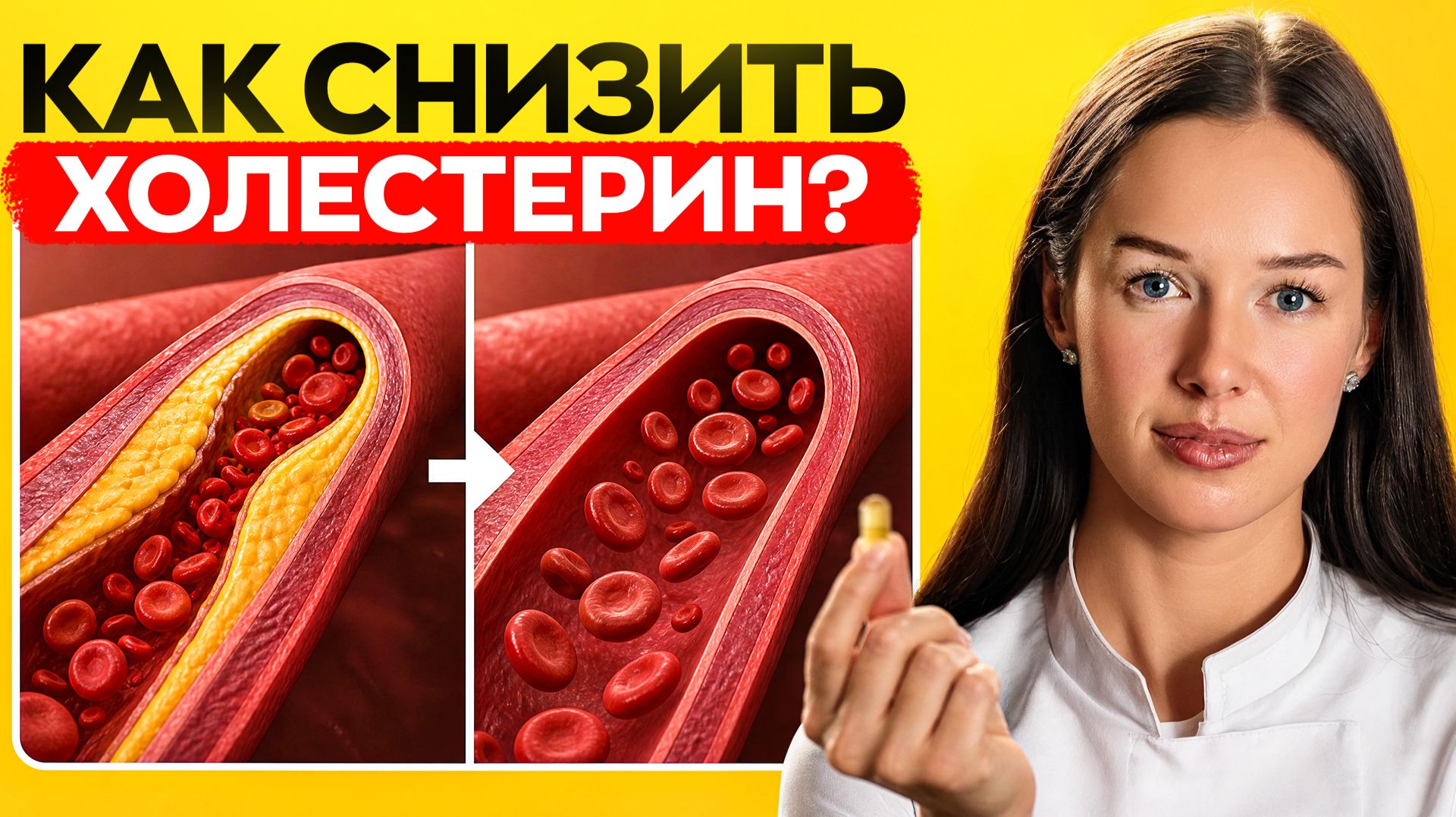 Холестерин — как снизить его безопасно и когда нужно это делать смотреть онлайн