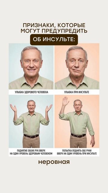 Признаки инсульта. Юсуповская Больница смотреть онлайн