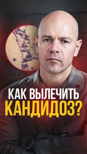 Хроническая молочница - какие причины могут стоять за этим?