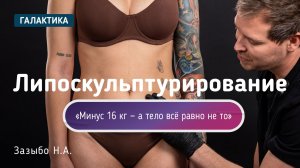 Липоскульптурирование тела после родов | Анна у Николая Зазыбо