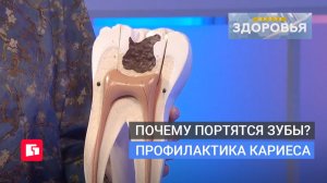 Почему портятся зубы? Профилактика кариеса. Школа здоровья. GuberniaTV