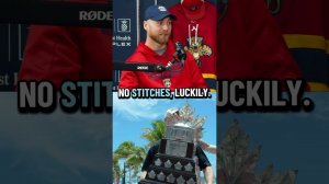 Conn Smythe injuries