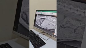Спасаем котика,, Шоколадке улучшений нет. стихия застала в пути