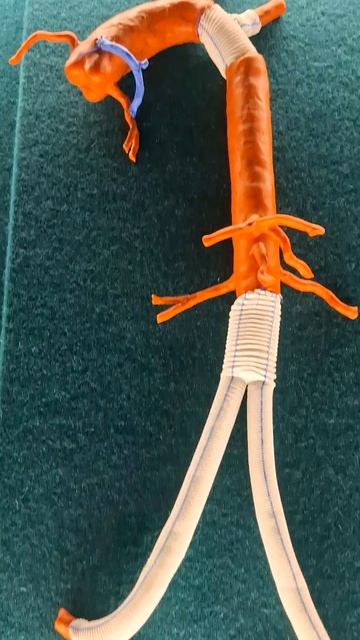 Искусственная аорта- протез - для человека❤️в Музее истории Медицины #здоровье #сердце #операция