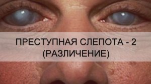 ПРЕСТУПНАЯ СЛЕПОТА-2. РАЗЛИЧЕНИЕ. Андрей Яковишин