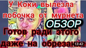 САМВЕЛ АДАМЯН, РАССТРОИЛСЯ ИЗ-ЗА БАБУШКИ, ПОБОЧКА У НИКОЛЕТТЫ, БЛАТНАЯ РАБОТА..