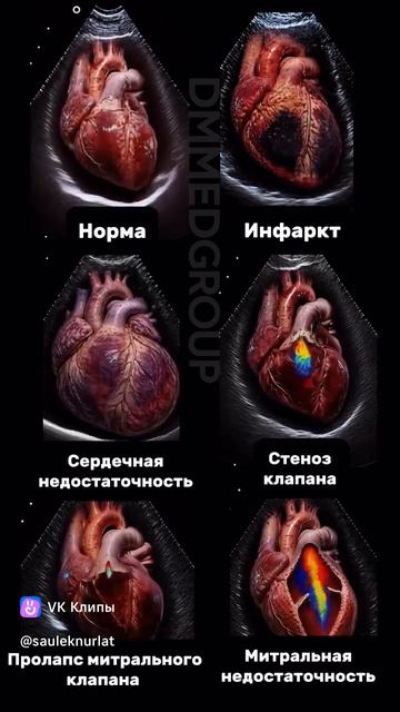 Сердце 🤍❤️🤍 смотреть онлайн
