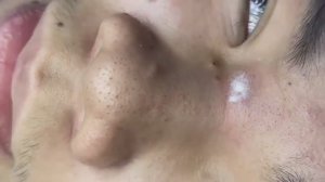 170 • Acne collection • АСМР • Relax Spa
