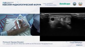Ультразвуковая диагностика заболеваний и травматических повреждений кисти sonoscape.ru
