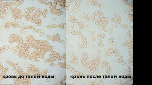 Кровь до и после талой воды под микроскопом ОВП рН TDS