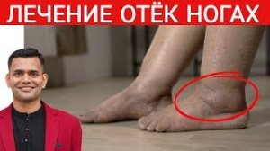 ВАШИ НОГИ ОТЕКАЮТ? ДЕЛАЙТЕ ЭТИ  ПРОСТЫЕ УПРАЖНЕНИЯ.
