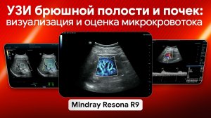 УЗИ брюшной полости и почек на Mindray Resona R9: эластография, оценка стеатоза и микрокровоток