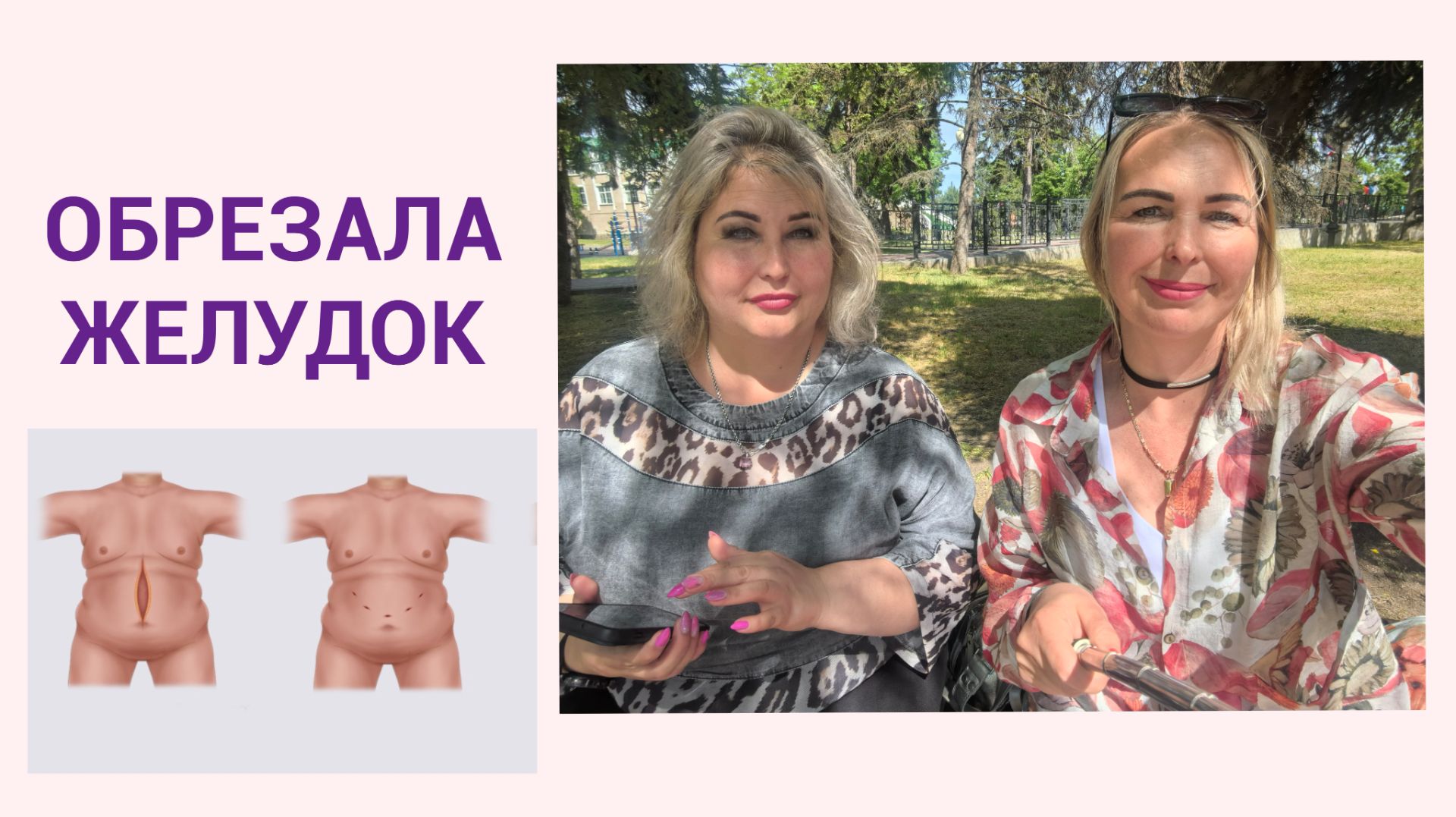 ПОХУДЕЛА НА 70 КГ ПОСЛЕ ОПЕРАЦИИ, А ПОТОМ ОПЯТЬ НАБРАЛА смотреть онлайн