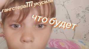 Гангстера777 укусили🥺🥺🥺
