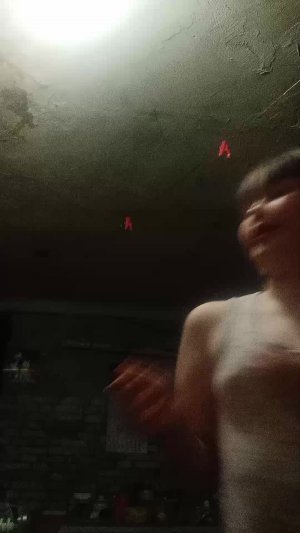 мальчики у меня синяк под глазом и ещё не те губы