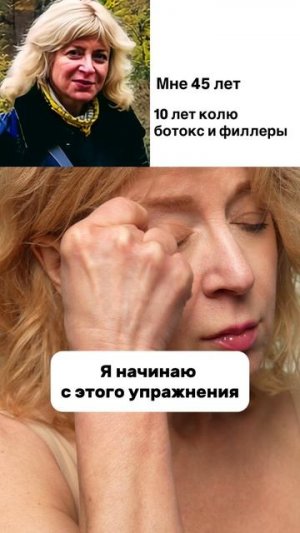 БОТОКС: моя история