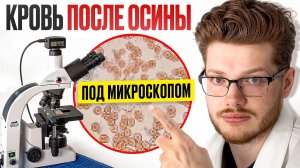 КРОВЬ ДО И ПОСЛЕ приема ОСИНЫ ПОД МИКРОСКОПОМ! - ОСИНА от ГУСТОЙ КРОВИ