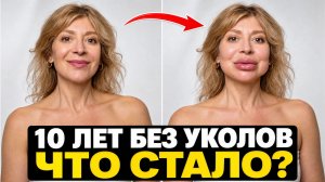 Я колола ВСЁ: ботокс, филлеры, нити. Смотреть всем, кто в 40-50 боится стать «старушкой»