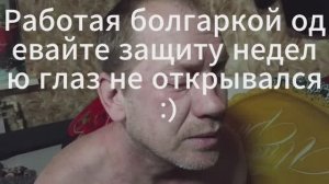 Вот что бывает когда без защиты болгаркой работаешь :)