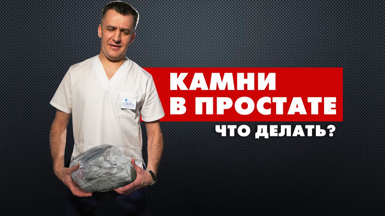 КАМНИ В ПРОСТАТЕ. Что делать?