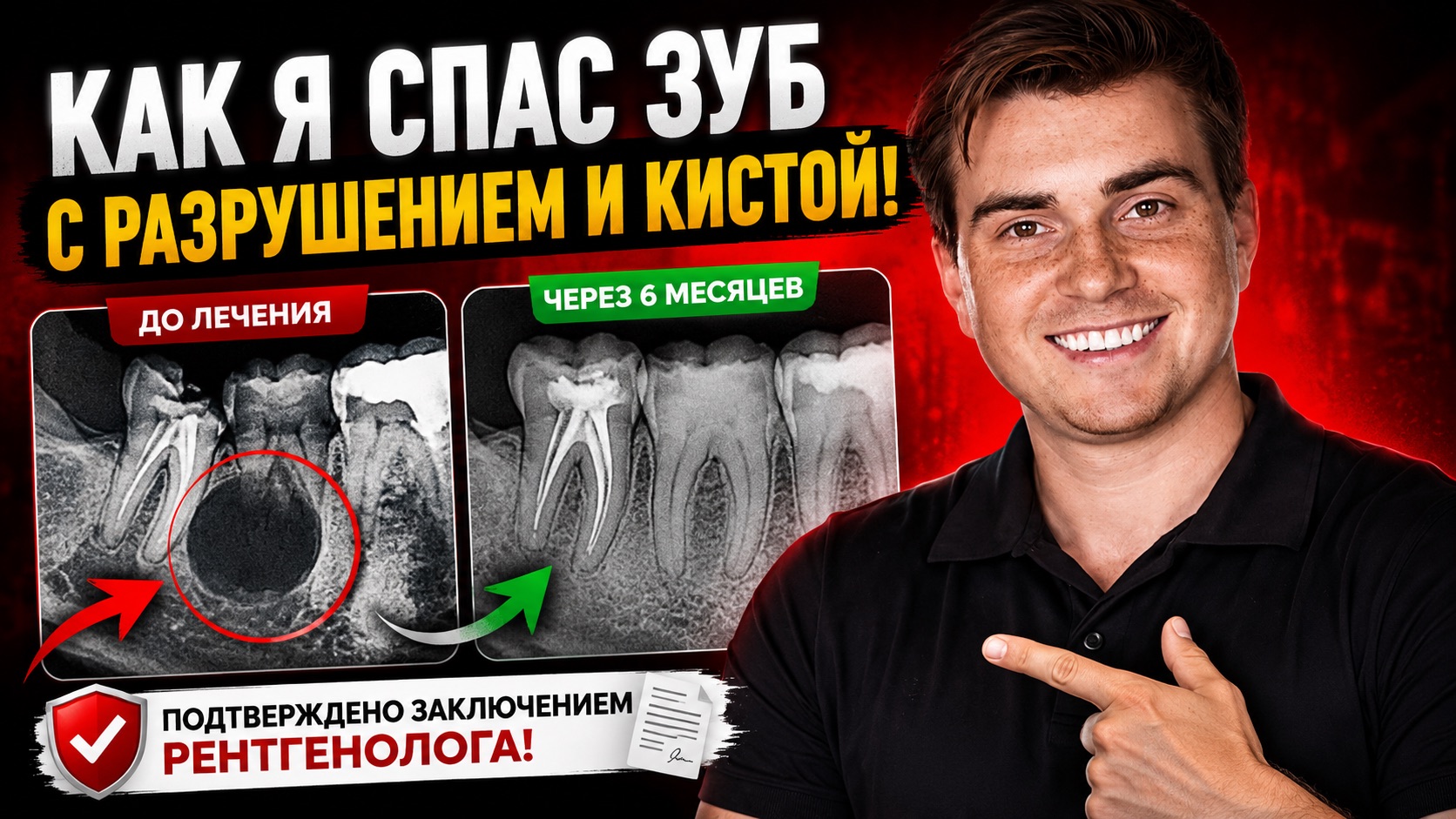 Зуб приговорили к удалению? Не удаляй!