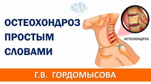 Что такое остеохондроз простыми словами