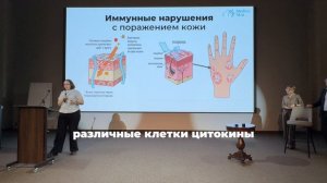 Поражение кожных покровов псориазом
