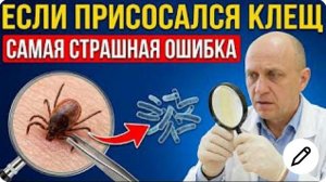 НИКОГДА не тяните КЛЕЩА пинцетом! 3 шага, которые  спасут от блезни Лайма (бореллиоз)