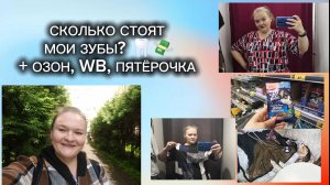 Сколько стоят мои зубы? Озон, WB, Пятёрочка и...рассказала о стоимости имплантации