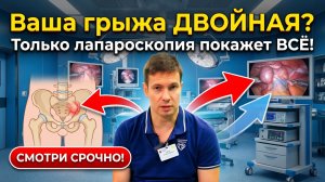 Паховая грыжа: скрытая угроза с другой стороны‼️