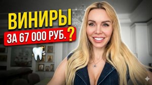 Как ЗАБЫТЬ МОЛОДОГО партнера? Честно о чувствах и... ВИНИРАХ