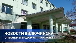 Первые операции методом лапароскопии