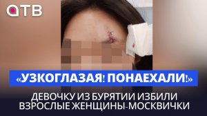 «Узкоглазая! Понаехали!»: девочку из Бурятии избили взрослые женщины-москвички| Интервью с отцом