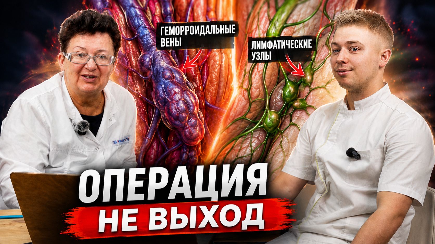 Не спеши удалять гемморой. Лечи Причину! смотреть онлайн