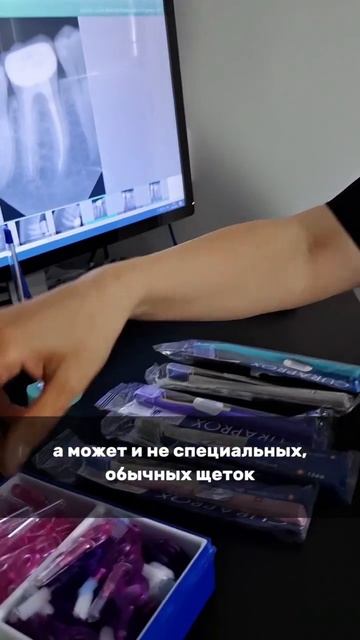 Уход за зубными имплантатами | что важно знать