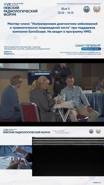 Методика УЗИ сгибательного аппарата кисти и пальцев