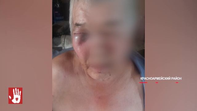 Выдавливал глаза Житель Якупово жестоко избил соседа из-за огорода
