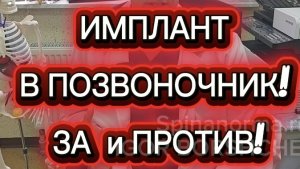 ИМПЛАНТ В ПОЗВОНОЧНИК!