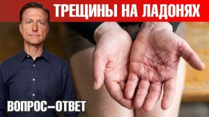 Экзема на ладонях: почему кожа не заживает и что делать?