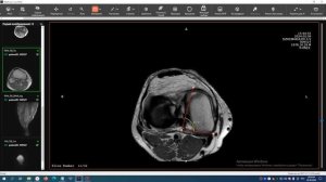 medvision