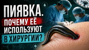 Пиявка - почему её используют в хирургии?