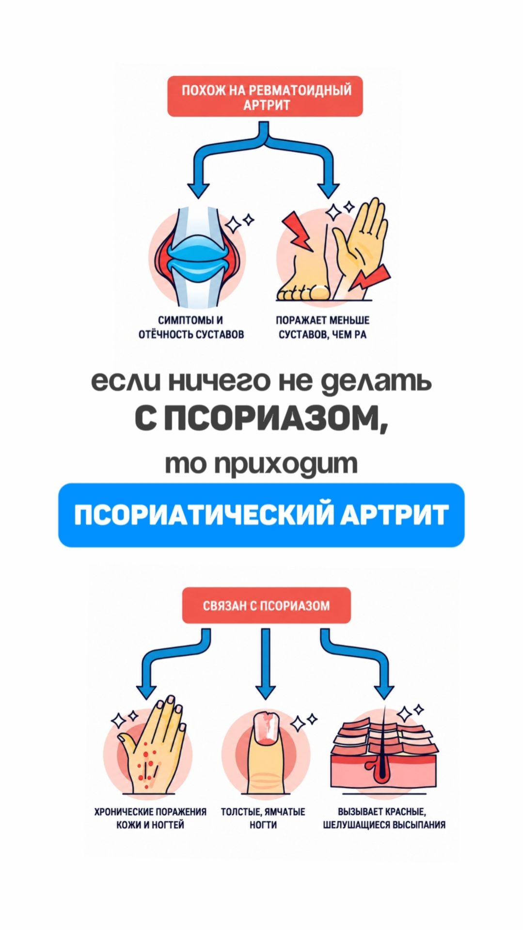 Если вовремя не разобраться с псориазом, приходит псориатический артрит. Алена Братишко