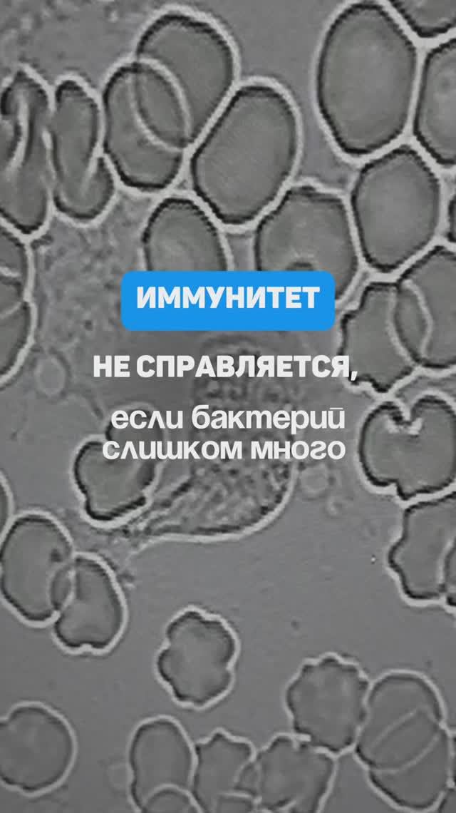 Иммунитет не справляется, когда в крови слишком много бактерий и грибков. Алена Братишко
