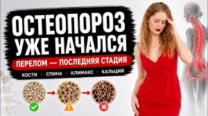 Жизнь без боли в спине: как остановить остеопороз и вернуть легкость движений